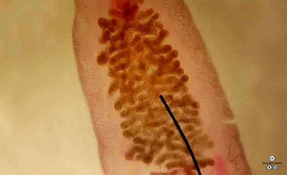 간디스토마의 현미경 사진. [사진 (cc) Sarah J. Wu]