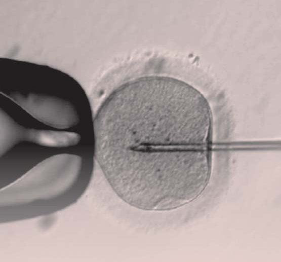  When SPATC1L was removed from experimental mice, the head and tail of the spermatozoon were separated without exception. The gene scissors technique (CRISPER / Cas9) was used in this experiment. [중앙포토]