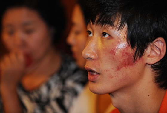 스타 선수 박철우도 10 년 전 폭행을 잊을 수 없다 “피가 거꾸로 뛰고있다”
