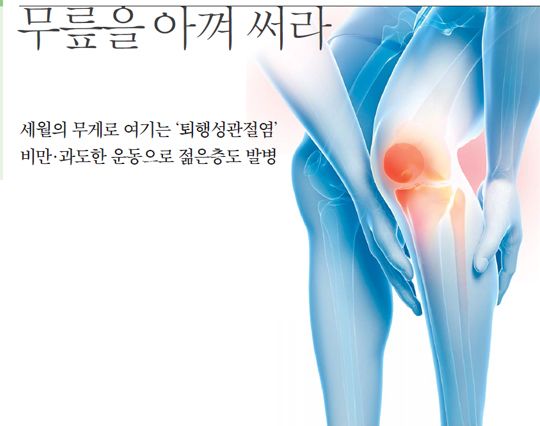 무릎 관절염 증상