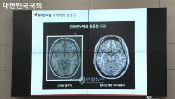 [사진 유튜브]