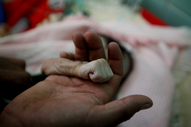 내전을 겪고 있는 예멘의 사나지역에 위치한 알 사빈 병원에서 지난 11월 15일 아이의 아버지가 태어난지 4개월 만에 영양실조로 사망한 딸의 손을 잡고 있다. [로이터=연합뉴스] 