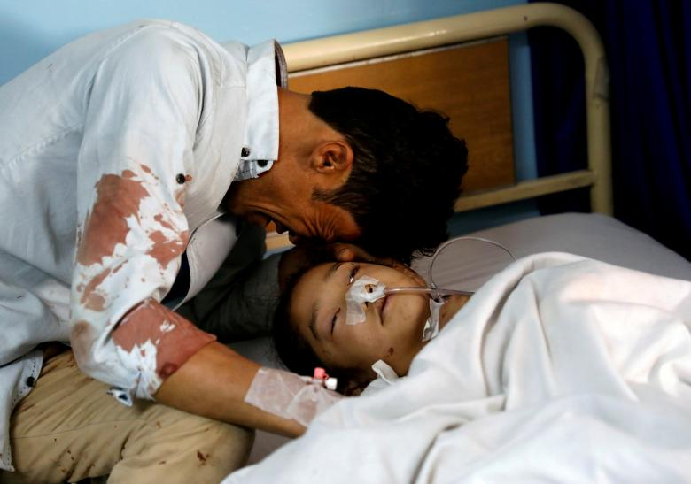 지난 4월 22일 아프가니스탄 카불의 한 병원에서 아이의 아버지가 자살폭탄테러로 부상을 입은 소녀의 병상에서 눈물을 흘리고 있다. [로이터=연합뉴스]