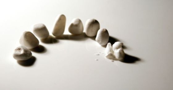 치아 손실을 경험한 폐경기 여성은 자연치가 남아있는 폐경기 여성보다 고혈압이 발생활 확률이 20% 더 높은 것으로 조사됐다. [중앙포토] 