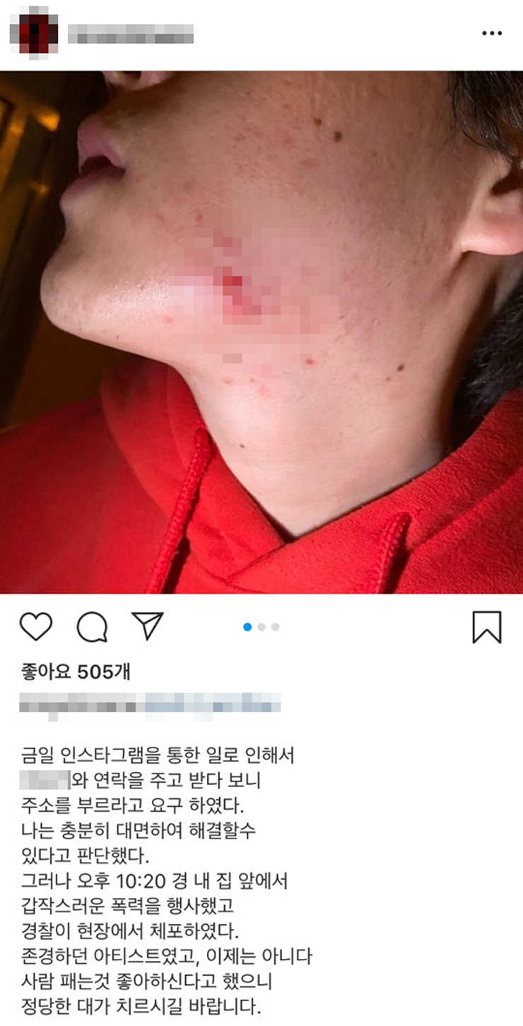서울 용산경찰서는 폭행 혐의로 30대 래퍼 1명을 입건해 수사하고 있다. 폭행을 당한 래퍼는 자신의 인스타그램에 폭행당한 얼굴 등을 공개했다. 사진 인스타그램 캡처