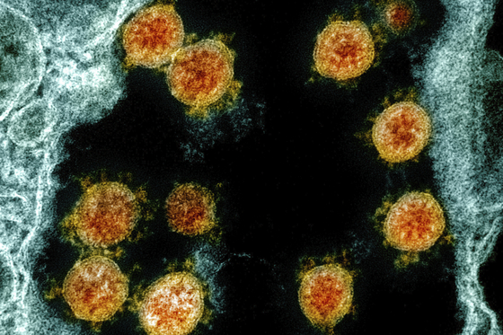 A new coronavirus observed with an electron microscope at the National Institute of Allergy and Infectious Diseases (NIAID). [AP=연합뉴스]