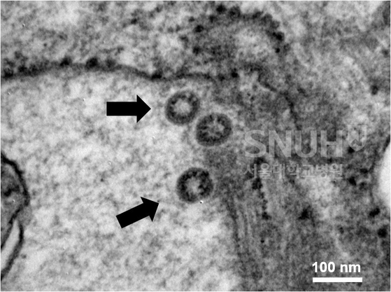 An electron microscope image that allows you to visually verify the Corona 19 virus. [서울대병원 감염내과 제공, 연합뉴스]