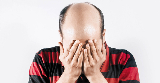 China’s total hair loss area is 10 times larger than Seoul…  Even 90’s students plant hair