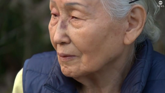 뉴욕 한복판 80 대 한국 할머니가 폭행 당해 기절 … “증오 범죄”