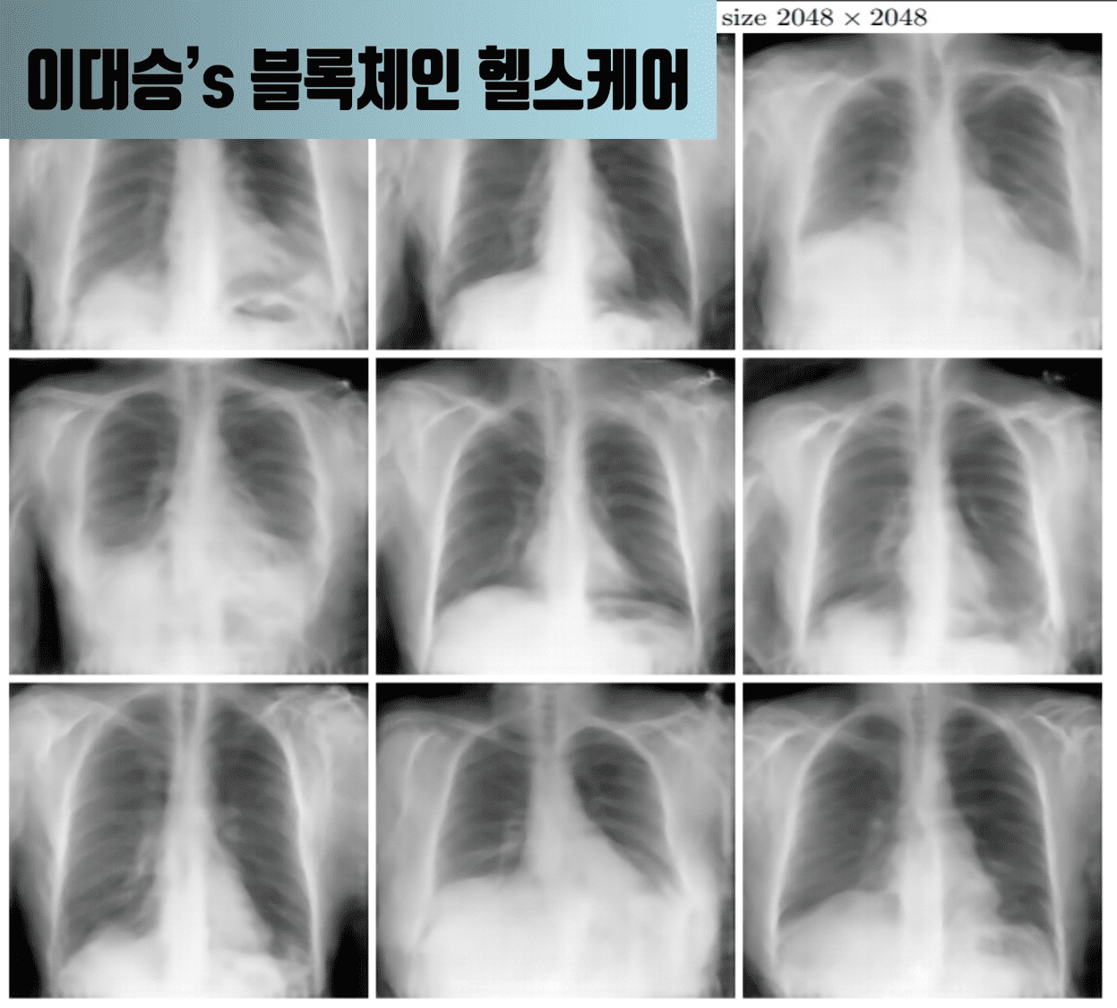 [이대승] 내 X-ray 사진이 은밀하게 누출되면 어떻게합니까?